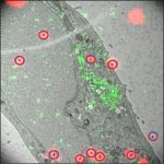 CLEM image of fiducials based on a gold core coated with fluorescently labeled silica drop casted on a section of embedded Hela cells. 